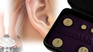 Akupunkturmagnete zur Gewichtskontrolle