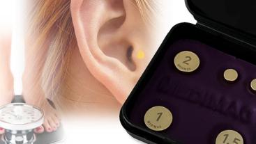 Akupunkturmagnete zur Gewichtskontrolle